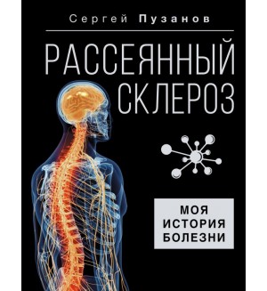 Пузанов С. Рассеянный склероз. Моя история болезни. Здоровье Рунета